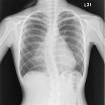Good price Độ sắc nét cao X-ray Phim y khoa nha khoa khô, phim hình ảnh khô. trực tuyến