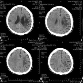 Good price Phim chụp ảnh khô X Ray trực tuyến