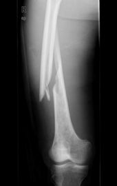 Hình ảnh y tế Konida Laser X Ray