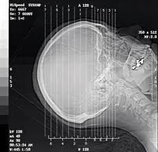 Good price Silver Halide Laser X Ray Chẩn đoán hình ảnh, Phim trong suốt chống nước A3 / A4 trực tuyến