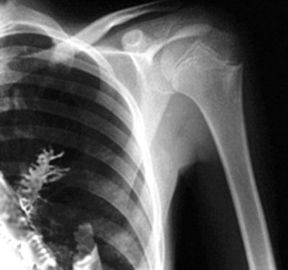 Good price Phim in nhiệt X Ray trực tuyến