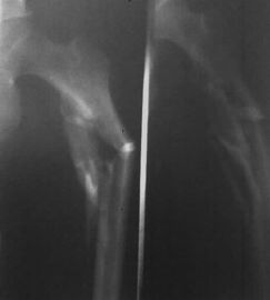 Good price Phim in nhiệt 43cm x 35cm, Phim X-Ray y tế Fuji khô trực tuyến