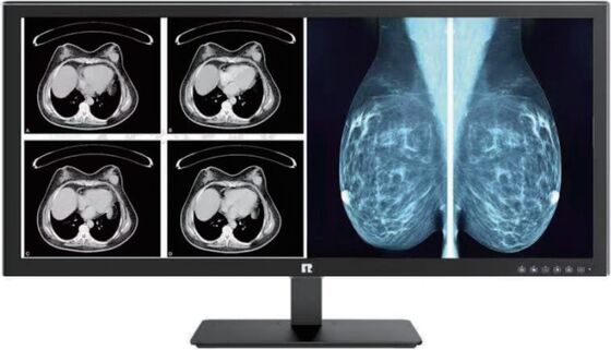 Giá tốt Màn hình y tế độ nét cao tuân thủ DICOM dành cho hình ảnh cấp độ X quang trực tuyến