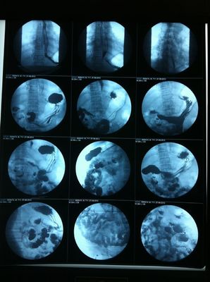 Good price Máy in phun mờ X Ray Phim in lụa bề mặt bóng trực tuyến