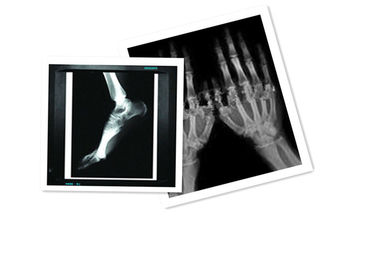 Hosipital PET Film Y tế X Ray Giấy chống nước 8 × 10 Inch CT Film White
