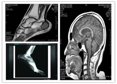 Good price Phim kỹ thuật số y tế Blue Base khô hình ảnh 8 x 10in Tương thích Hosipital Mri Scan trực tuyến