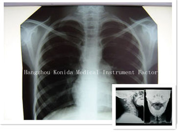 Phim y tế kỹ thuật số X Ray khô 14 x 17inch Phim chụp ảnh phóng xạ sức khỏe