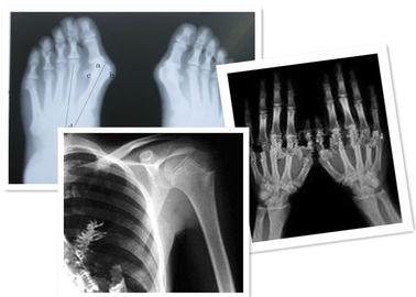 Nhiệt kỹ thuật số X Ray Film Fuji y tế để kiểm tra phóng xạ