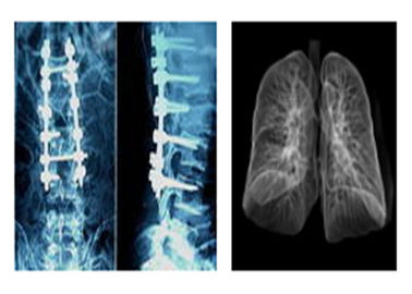 Phim X quang sắc nét y tế X quang, phim chụp ảnh khô kỹ thuật số Mri Dr Ct