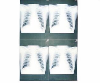 Good price Kem dưỡng ẩm White Base Medical X Ray Film Film cho máy in Sony / Epson Laser trực tuyến