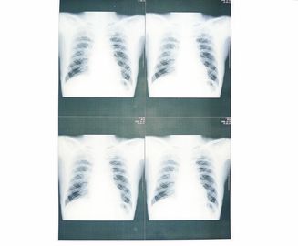 Kem dưỡng ẩm White Base Medical X Ray Film Film cho máy in Sony / Epson Laser