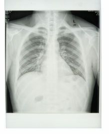 Good price Phim y tế giấy Xray trắng tùy chỉnh 25cm * 30cm với vật liệu PET trực tuyến