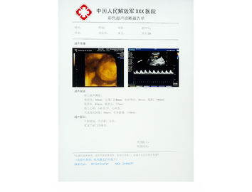 Phim y tế bằng giấy X-quang chống trầy xước cho KND-DRYTEC-3000, KND-DRYTEC-4000