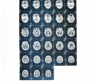 Máy in Laser giấy y tế Chẩn đoán hình ảnh X Ray cho bệnh viện