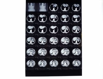 Good price Mật độ cao X phim kỹ thuật số trực tuyến