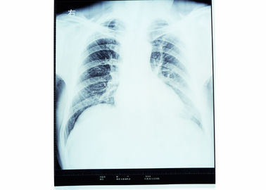 Phim chụp ảnh khô y tế X-ray 10 x 14 Nhiệt nhạy cảm cho máy in Fuji