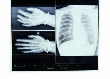 Hình ảnh y tế X Ray Dry Film 14 x 17 Konida, Mật độ cao