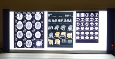 Good price Máy in nhiệt khô y tế X Ray trực tuyến