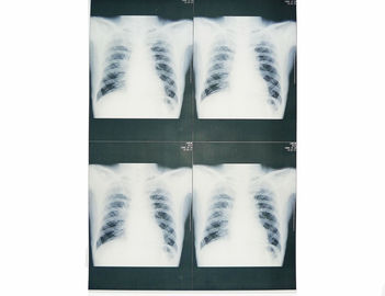 Phim X Ray y tế có thể đeo được, Phim X-quang hình ảnh y tế