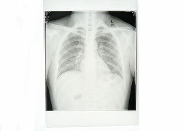 Giấy trắng y tế Ngực X Ray Film Không thấm nước Độ sắc nét cao