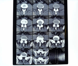 Good price 8in * 10in 14in * 17in Phim in nhiệt X-quang y tế mật độ cao trực tuyến