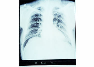 Good price X-quang chẩn đoán hình ảnh y tế khô X Ray cho AGFA / FUJI 2000 trực tuyến