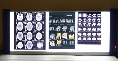 Độ sắc nét cao Phim chiếu trong suốt X-quang y tế Konida cho máy in AGFA / Fuji