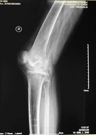 Good price Phim chụp ảnh khô y tế sương mù thấp KND-A để kiểm tra X Ray trên AGFA 5300, 5302, 5500 trực tuyến
