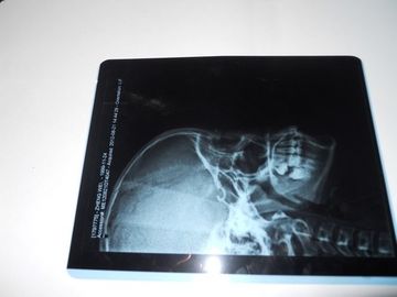 Good price Phim chụp ảnh khô y tế thân thiện với môi trường KND-A để kiểm tra X Ray trên AGFA 5300 trực tuyến