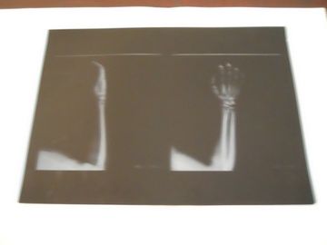 Phim chụp ảnh khô y tế sương mù thấp KND-A để kiểm tra X Ray trên AGFA 5300 11in × 14in