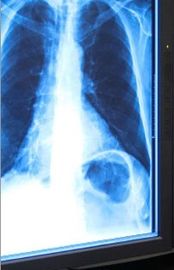 Phim chụp ảnh y tế khô X-quang màu xanh 11in x 17in cho máy in nhiệt